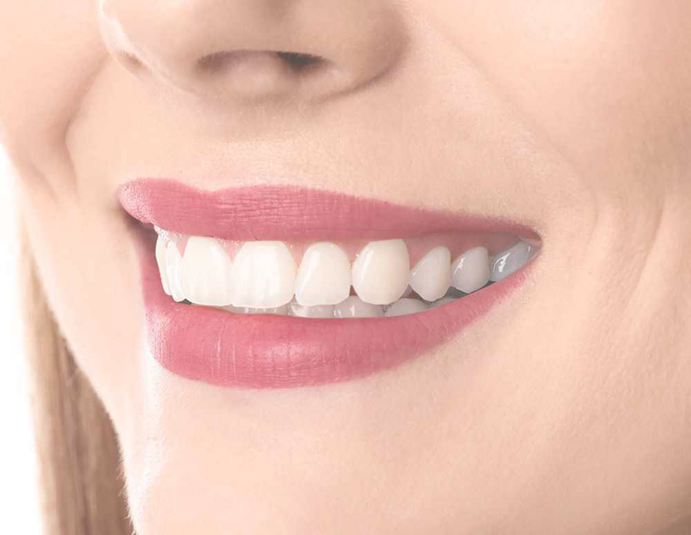 https://www.luxdental.com.au/wp-content/uploads/2021/04/teeth-after1.jpg