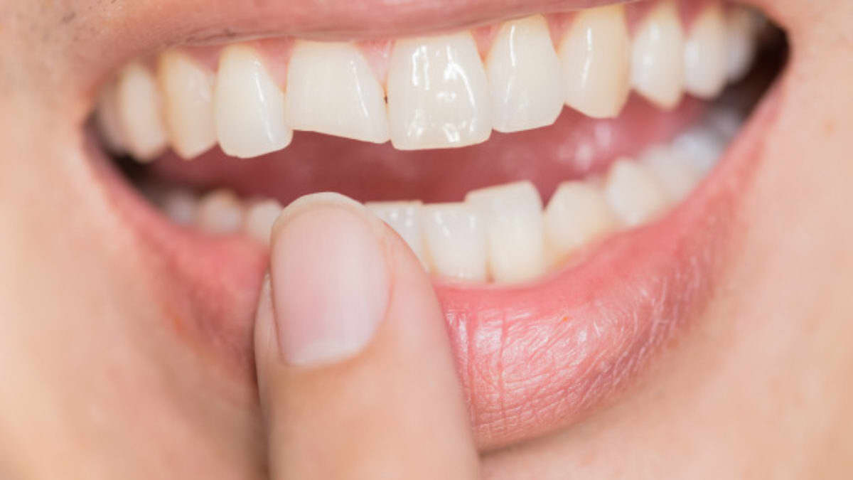 https://www.luxdental.com.au/wp-content/uploads/2021/05/cosmetic-dentistry2.jpg